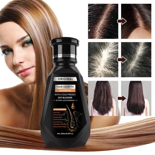 Biotin DHT blocker shampoo with cold pressed formula for hair loss treatment and scalp health improvement.