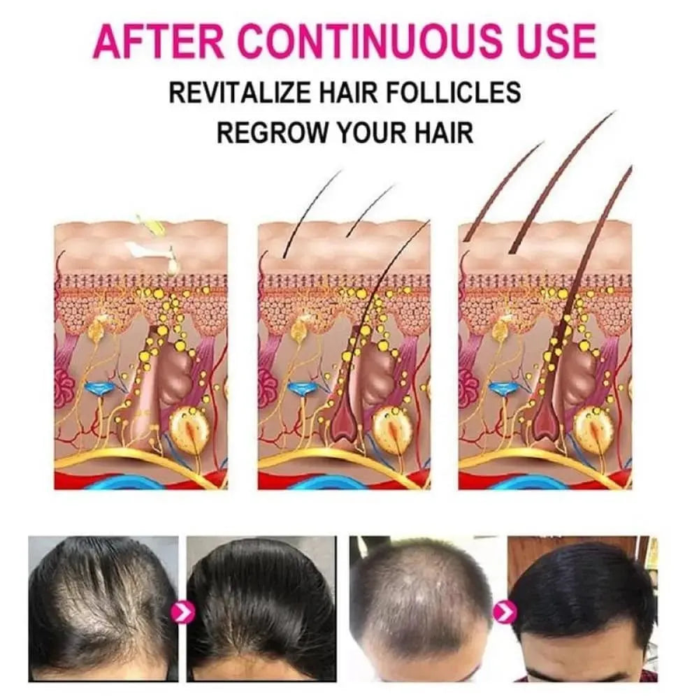 Anti-grey Hair Serum, 30ml - awanix.pk