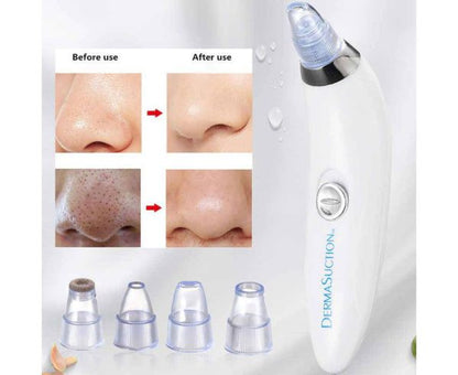 Blackhead Removal Machine-derma Suction - awanix.pk