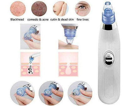 Blackhead Removal Machine-derma Suction - awanix.pk